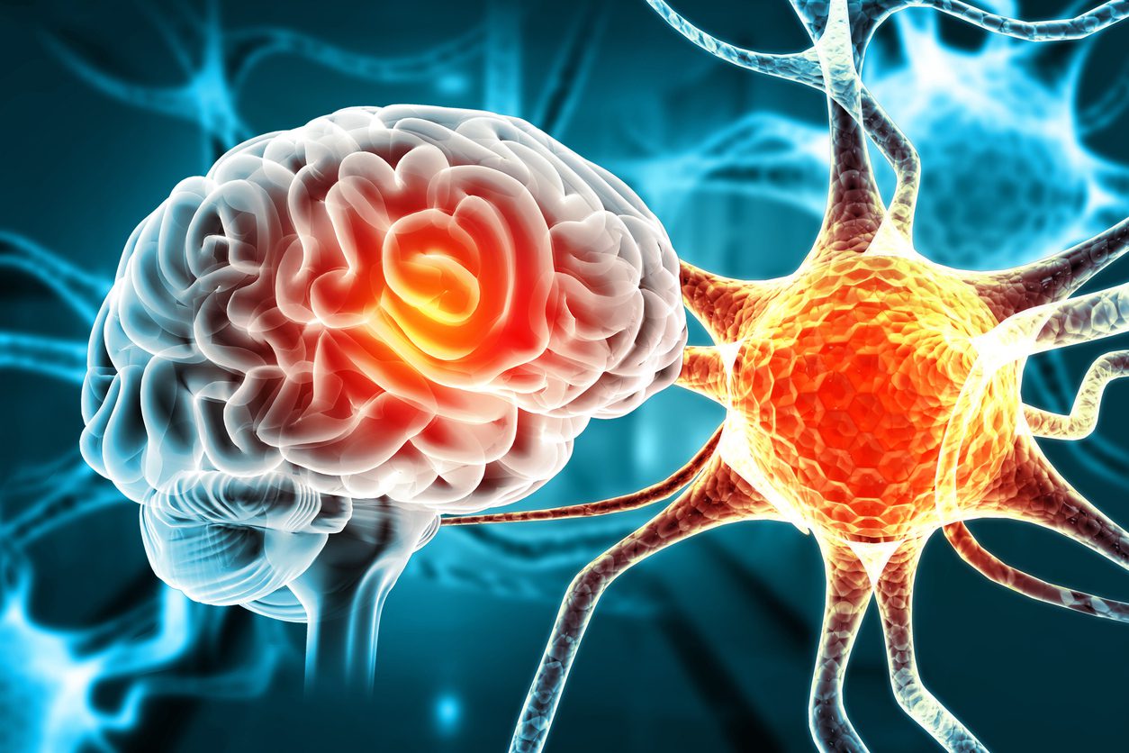 Brain on Fire: Anti-NMDA Receptor Encephalitis